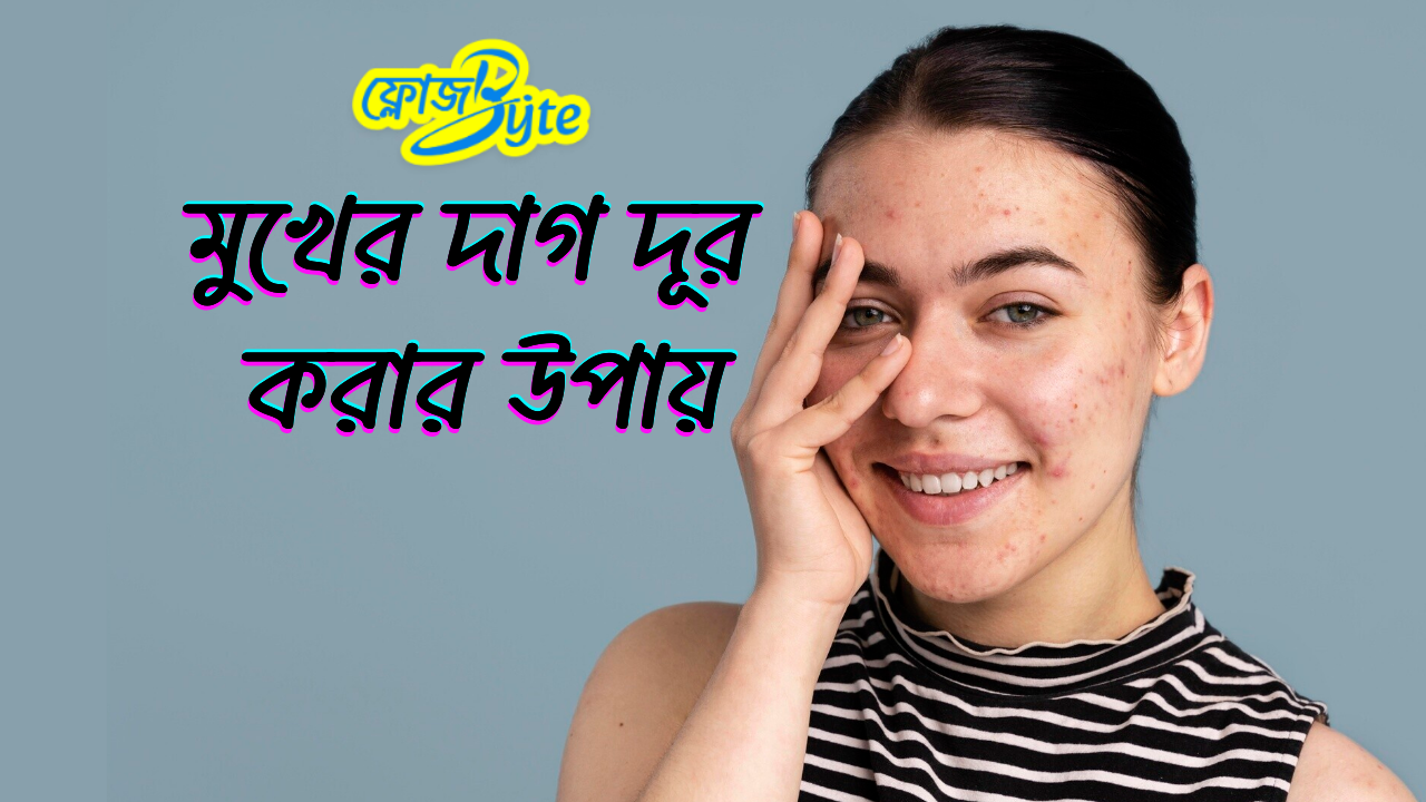মুখের দাগ দূর করার উপায়